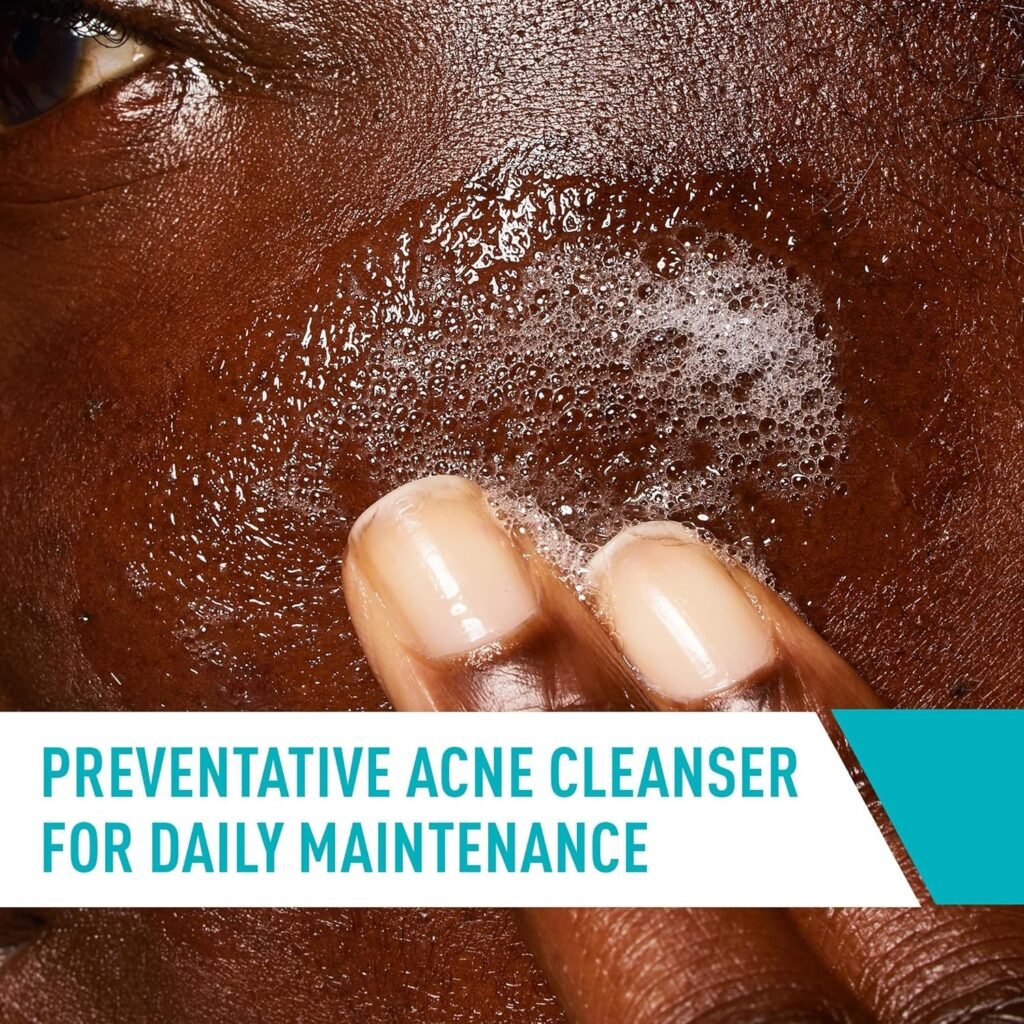 CeraVe Face Wash Acne Treatment